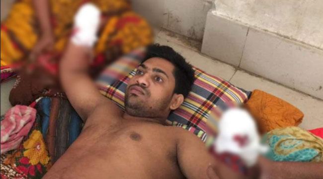 চাঁপাইনবাবগঞ্জে যুবকের ২ হাতের কবজি কেটে নিল প্রতিপক্ষ