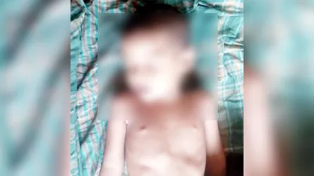 বালিয়াকান্দিতে পল্লী চিকিৎসকের ভুল চিকিৎসায় শিশু মৃত্যুর অভিযোগ