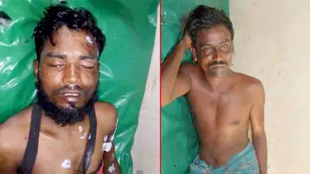 বঙ্গোপসাগরে মাছ ধরার ট্রলারে বজ্রপাত