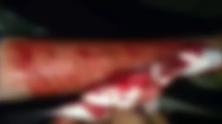 আওয়ামী লীগ কর্মীর পায়ের রগ কাটল যুবলীগ নেতা