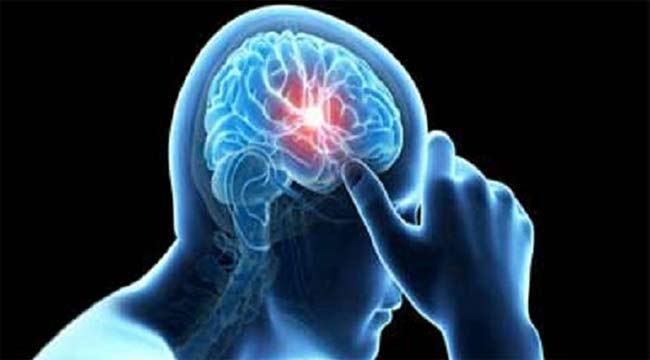 স্ট্রোক : লক্ষণ ও বাঁচার উপায়