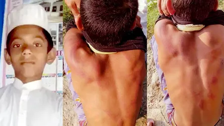 চুরির অভিযোগে শিশুকে এমন নির্যাতন!