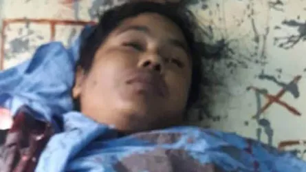 বগুড়ার শেরপুরে ট্রাকের ঘর্ষণে হাত হারালেন বাসযাত্রী মাকসুদা