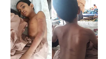 মাদরাসা ছাত্রকে চোখ-মুখ বেঁধে নির্যাতন