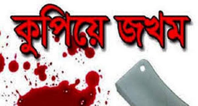 সোনারগাঁওয়ে সাবেক ইউপি সদস্যসহ ৩ জনকে কুপিয়ে জখম