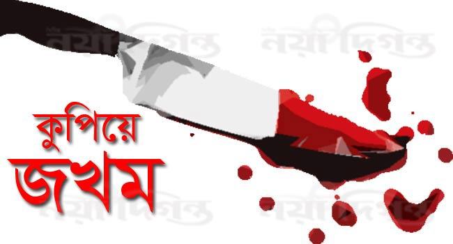 এমপির পিএসসহ ২ জনকে কুপিয়ে জখম