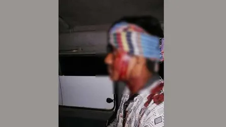 রাবি শিক্ষার্থীর মাথা ফাটালেন ছাত্রলীগের ২ নেতা : মহাসড়ক অবরোধ