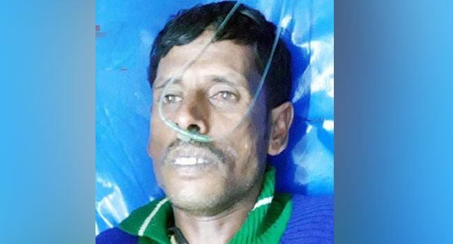 মুখে সুপার গ্লু দিয়ে ছিনতাই