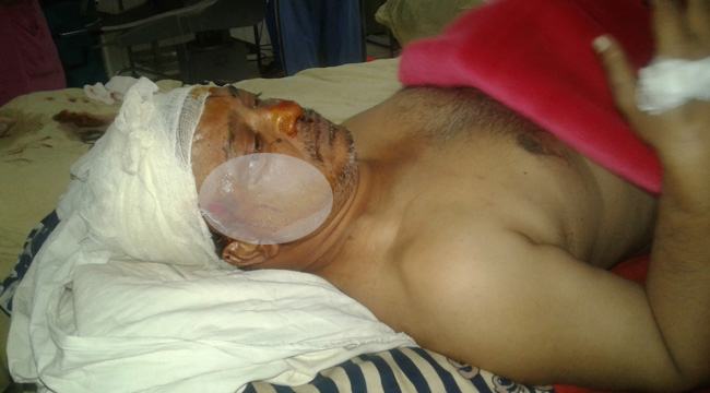 ফরিদপুর প্রেসক্লাবের সাবেক সভাপতি সন্ত্রাসী হামলায় গুরুতর আহত