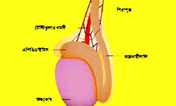 অণ্ডকোষে ব্যথা