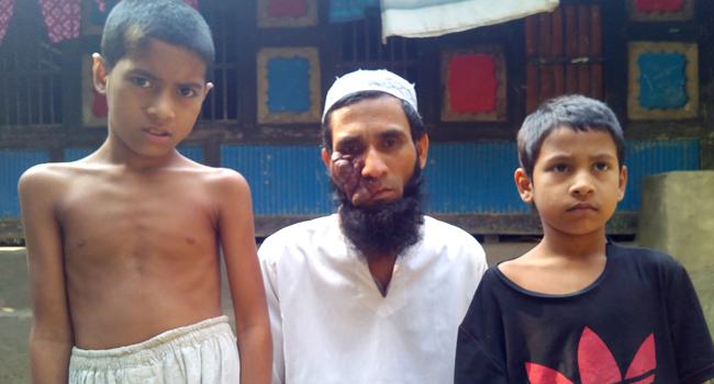 তিল থেকে বিরল রোগে আক্রান্ত বাবা ও দুই শিশু সন্তান
