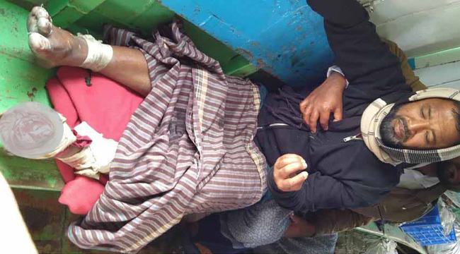 রাঙ্গাবালীতে বন্য শূকরের কামড়ে তিনটি আঙ্গুল হারালেন কৃষক