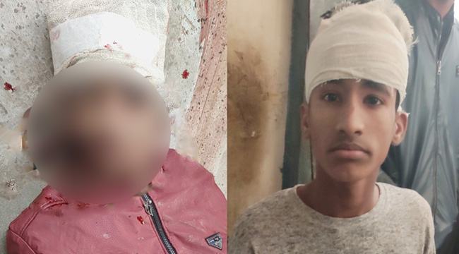 মটরসাইকেল দুঘর্টনা : প্রাণ গেল এক বন্ধুর, আরেকজন হাসপাতালে