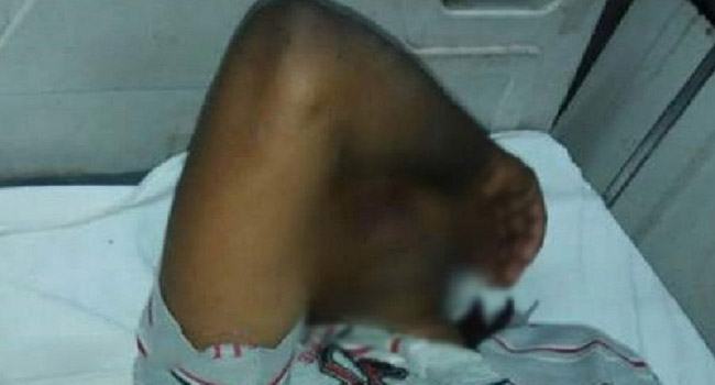 শ্বশুরবাড়িতে স্বামীর পুরুষাঙ্গ কাটলেন স্ত্রী