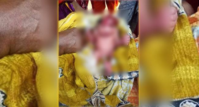 অদ্ভুত মুখমণ্ডলের কন্যা শিশুর জন্ম, দেখতে মানুষের ভিড়