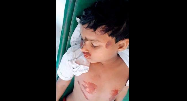 সাতক্ষীরায় ইজিবাইকের ধাক্কায় স্কুল ছাত্রী নিহত