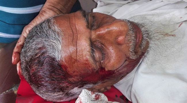 বামনায় ব্যাংকে বয়স্কভাতা তুলতে গিয়ে রক্তাক্ত হলেন বৃদ্ধ