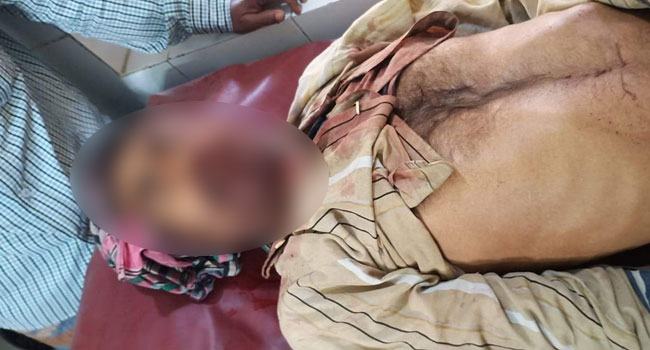 তালায় ট্রলির ধাক্কায় কৃষক নিহত