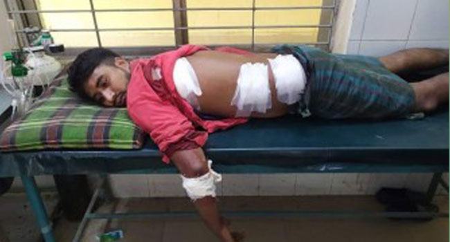 ভাতিজিকে ইভটিজিংয়ের প্রতিবাদ করায় চাচাকে কুপিয়ে জখম
