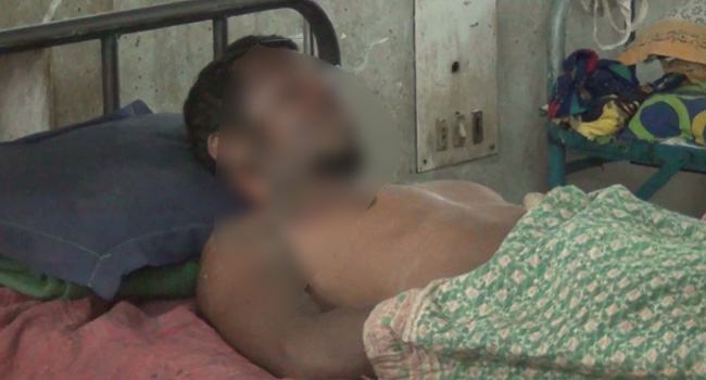 ভুত তাড়াতে যুবকের শরীরে আগুন, পুড়ে গেল ৭০ ভাগ