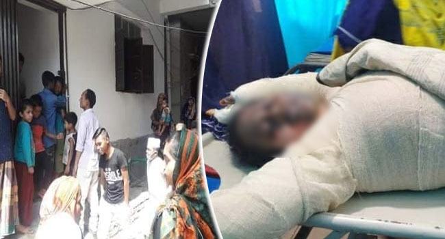 চুলার আগুনে দগ্ধ স্বামী-স্ত্রীর মধ্যে স্বামীর মৃত্যু