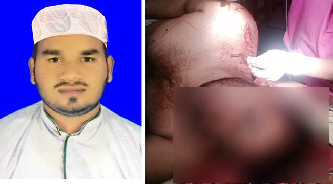 গোয়ালন্দে ঘুমন্ত ইমামকে কুপিয়ে জখম