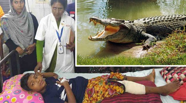 কুমিরের সাথে লড়াই করে প্রাণে বাঁচলো কিশোর