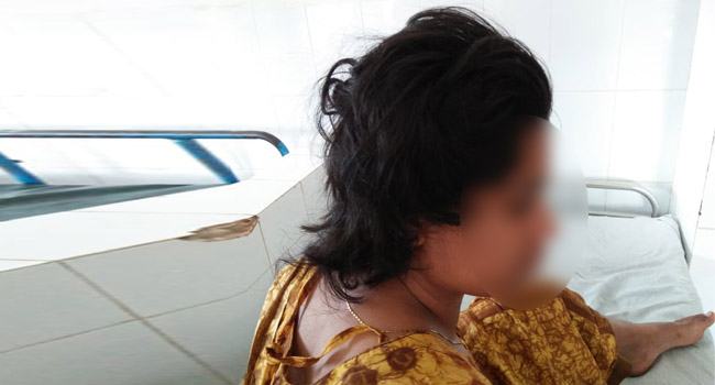 বিয়েতে রাজী না হওয়ায় তরুনীর চুল কেটে দিলো বখাটে
