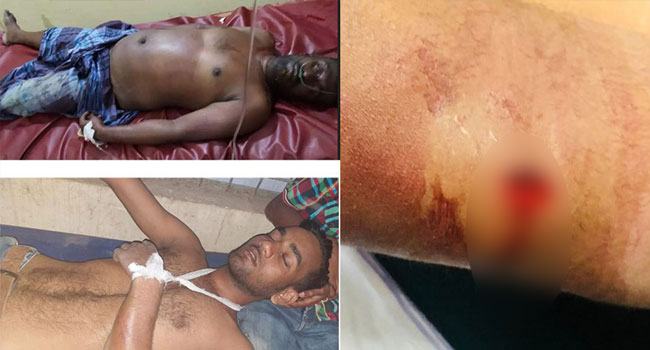 আ’লীগের দুই গ্রুপের হামলা-পাল্টা হামলায় আহত ৮