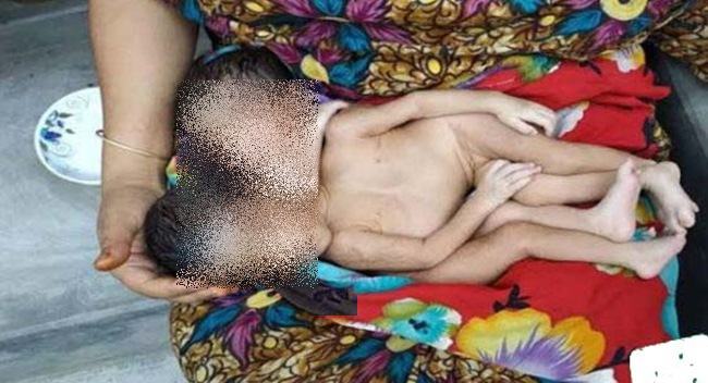 বুকজোড়া জমজ কন্যা শিশুর মৃত্যু