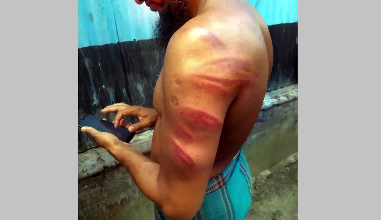 দেবিদ্বারে মাদরাসা শিক্ষককে বেধড়ক পেটালেন ইউপি চেয়ারম্যান