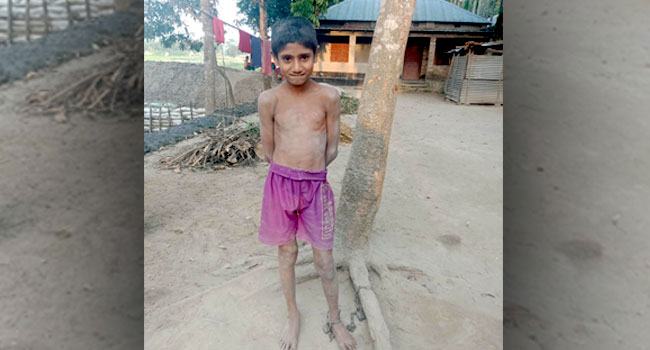 শিকলে বাঁধা শিশু পারভেজের জীবন
