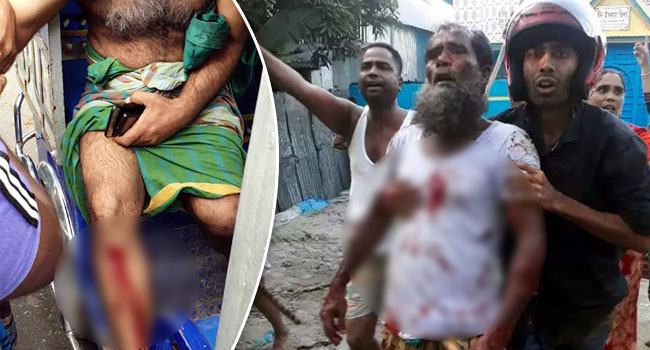 আড়াইহাজারে দুই গ্রুপের সংর্ঘষ, টেটাবিদ্ধসহ আহত ১০