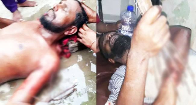জমি নিয়ে সংঘর্ষে ২ ভাই টেঁটাবিদ্ধ, থানায় পাল্টাপাল্টি মামলা