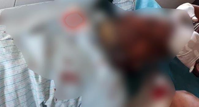 শ্যামনগরে প্রধান শিক্ষকের ওপর হামলার অভিযোগ
