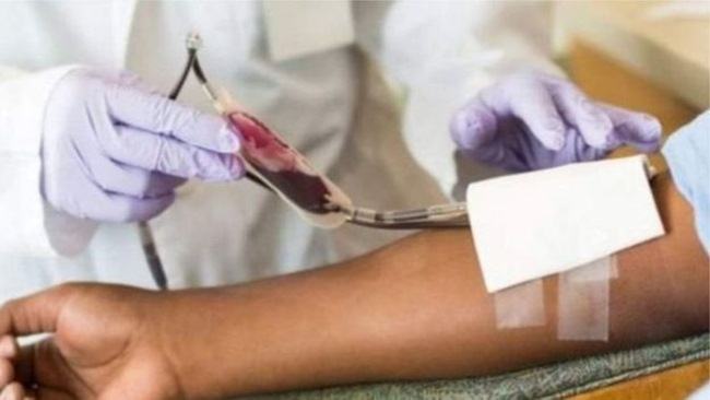 করোনা চিকিৎসায় দেশেও শুরু হলো প্লাজমা থেরাপি