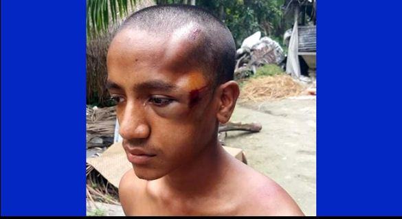 ট্রাফিক সার্জনের ক্ষোভে চোখ হারাতে বসেছে কিশোর রিকশাচালক