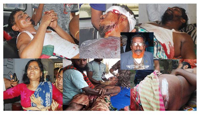 বোয়ালমারীতে পৃথক সংঘর্ষে আহত অর্ধশত, ভাংচুর লুটপাট আটক ১০