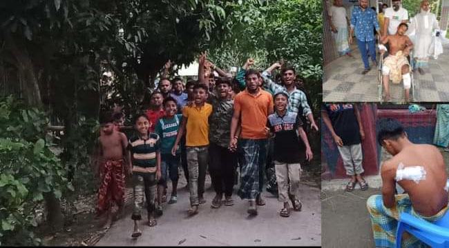 সোনারগাঁওয়ে দুই গ্রুপের সংঘর্ষে ইউপি সদস্যসহ ৫ জন আহত