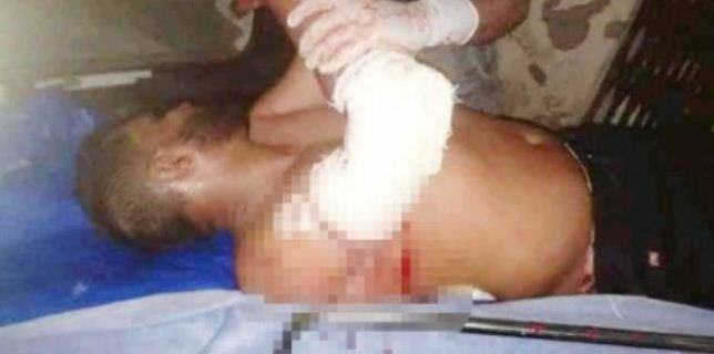 পুলিশকে কুপিয়ে জখম, গ্রেফতার ২