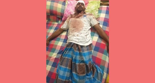 বিমানবন্দরে ব্যবসায়ীর উপর দুর্বৃত্তদের হামলা