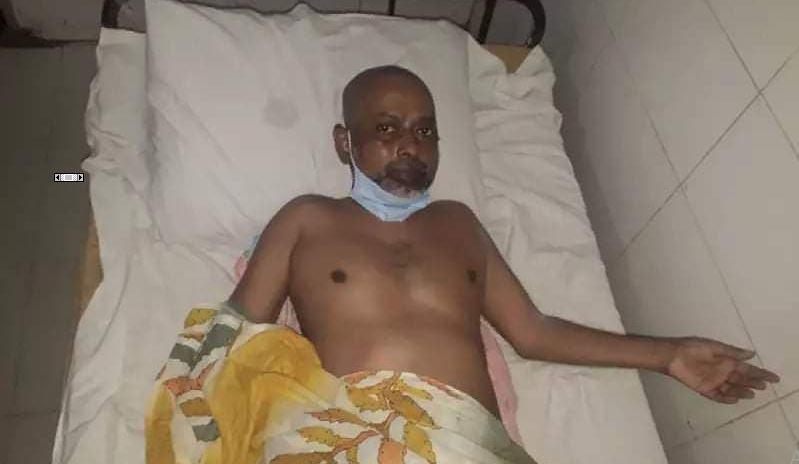 আগুনে পুড়ে যাওয়া মানুষের আকুতি : ‘আমি কি পচে গলে মরবো?’