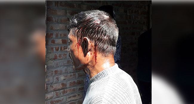 রাণীনগরে গরিবদের চাল ১০ টাকার বদলে ৩০ টাকা দাবি, সংঘর্ষে ডিলারসহ আহত ৫