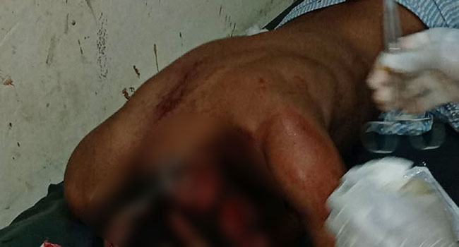 মিরসরাইয়ে দু’গ্রুপের সংঘর্ষে আহত ৩, আটক ২