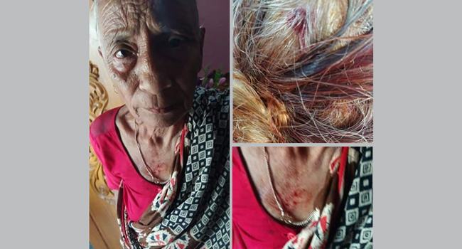 খাবার চাওয়ায় বৃদ্ধা মাকে মাথা ফাটিয়ে দিয়েছে ছেলে