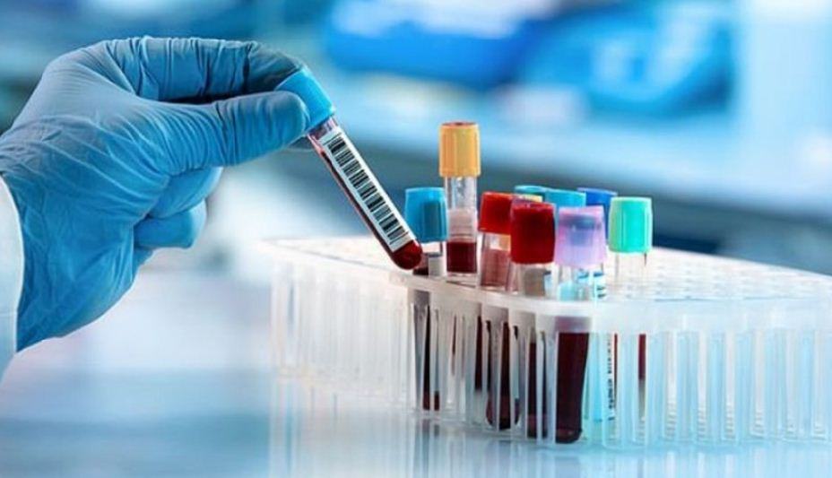 দেশে ১৬ দিনে ৫০ হাজার করোনা রোগী শনাক্ত
