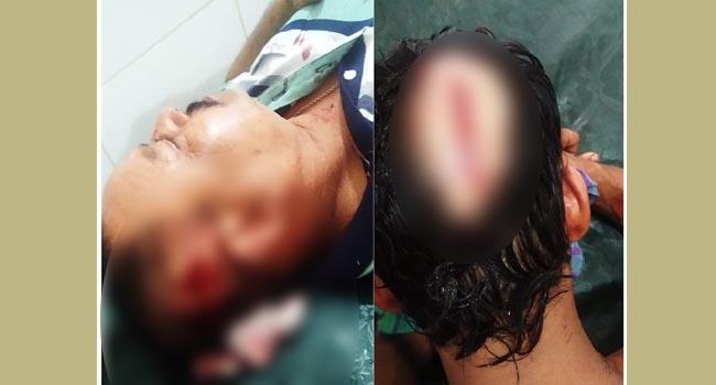 সোনারগাঁওয়ে চাঁদা না দেয়ায় সাবেক ইউপি চেয়ারম্যানসহ ৩ জনকে কুপিয়ে জখম