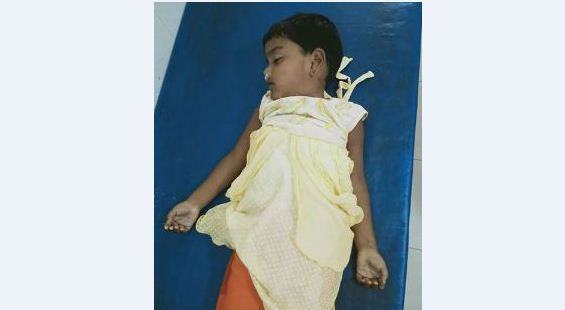 এসিডপানে শিশুর  মর্মান্তিক মৃত্যু