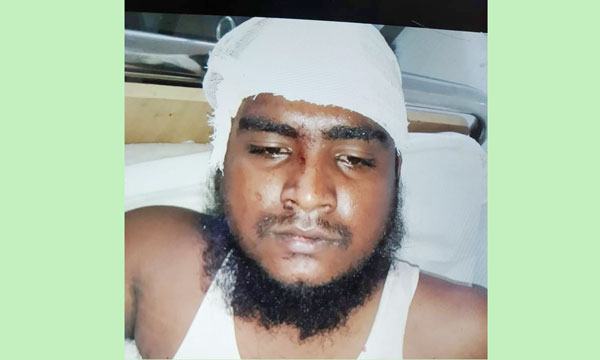 সোনারগাঁওয়ে অটোরিকশা চালককে পিটিয়ে জখম