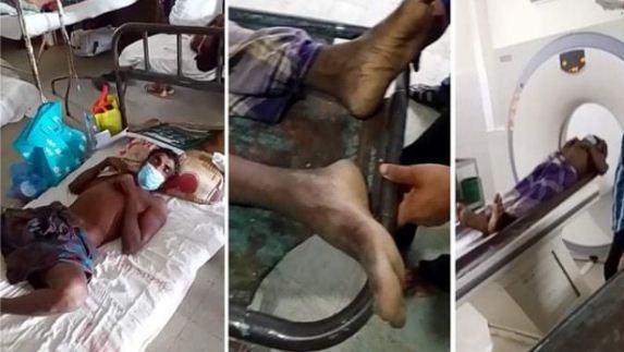 সমাজচ্যুত করে ক্ষান্ত হয়নি, পিটিয়ে হাসপাতালে পাঠালো মোড়ল